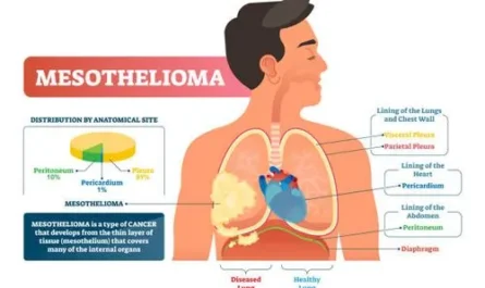 Understanding Mesothelioma: Causes, Symptoms, and Legal Options