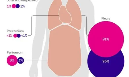 Symptoms of Mesothelioma: What to Watch For | Insights from Cancer Research UK